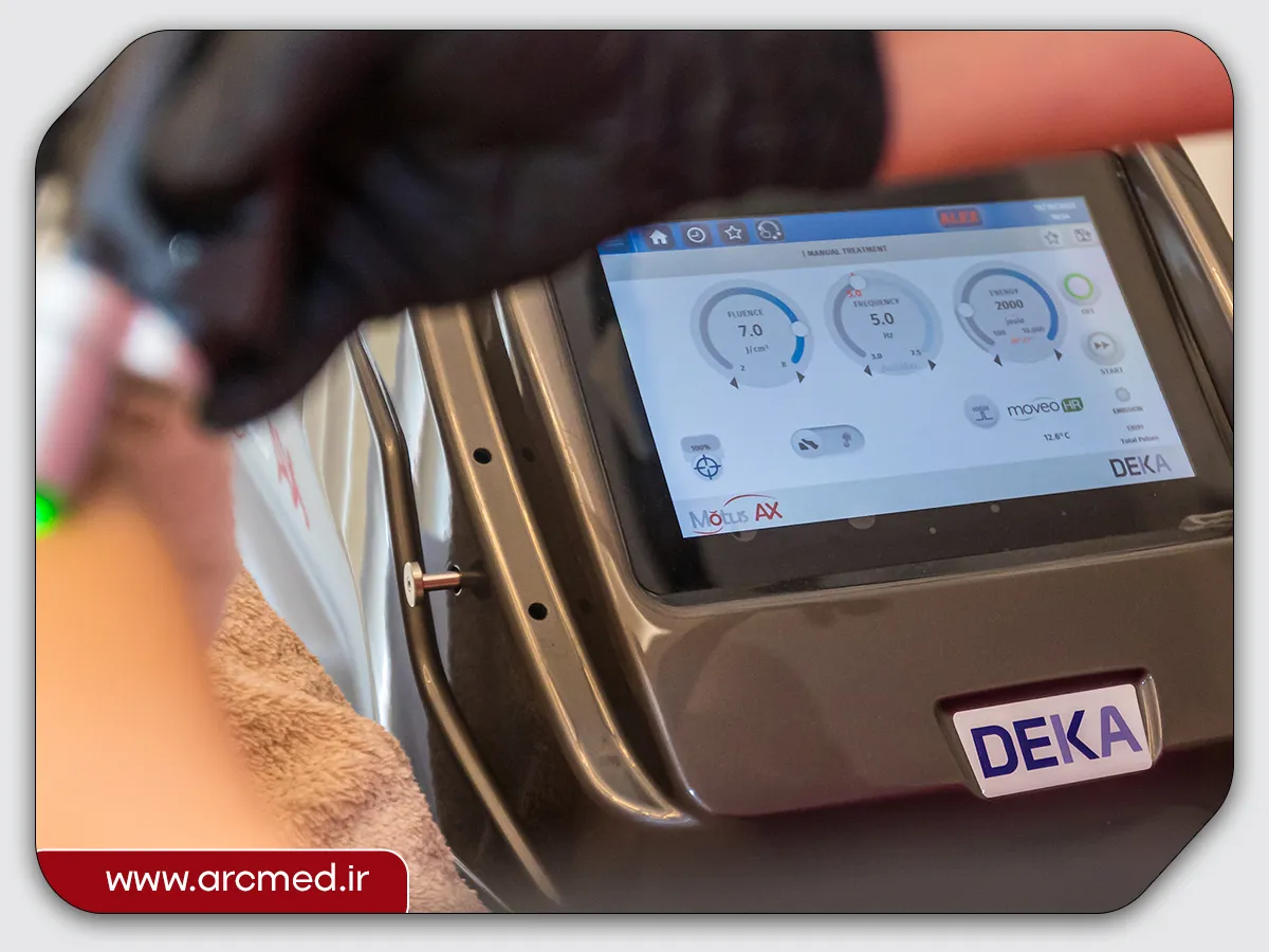 دستگاه لیزر الکساندرایت دکا