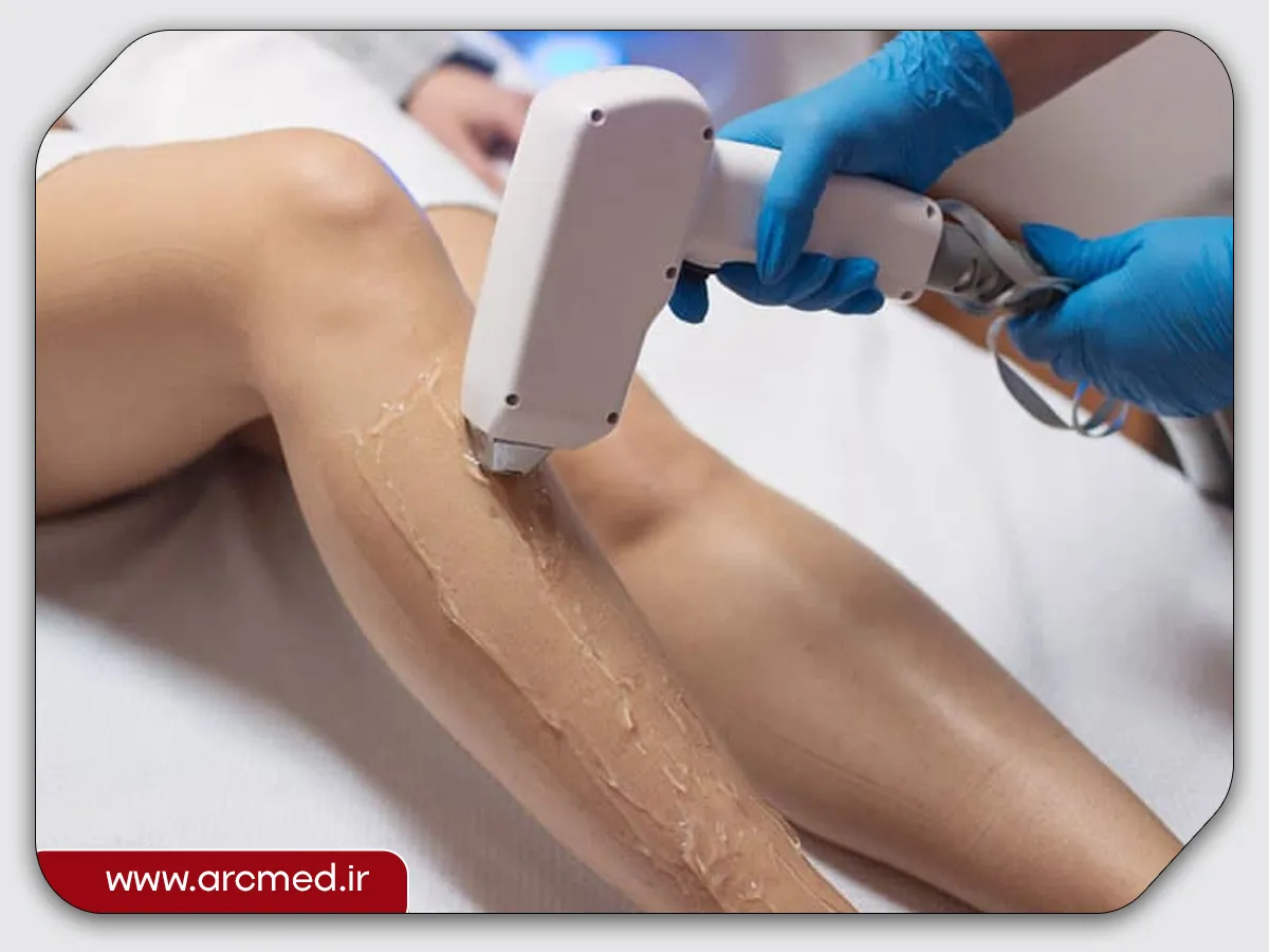 دستگاه لیزر دایود 3 لیزر موهای زائد دایود