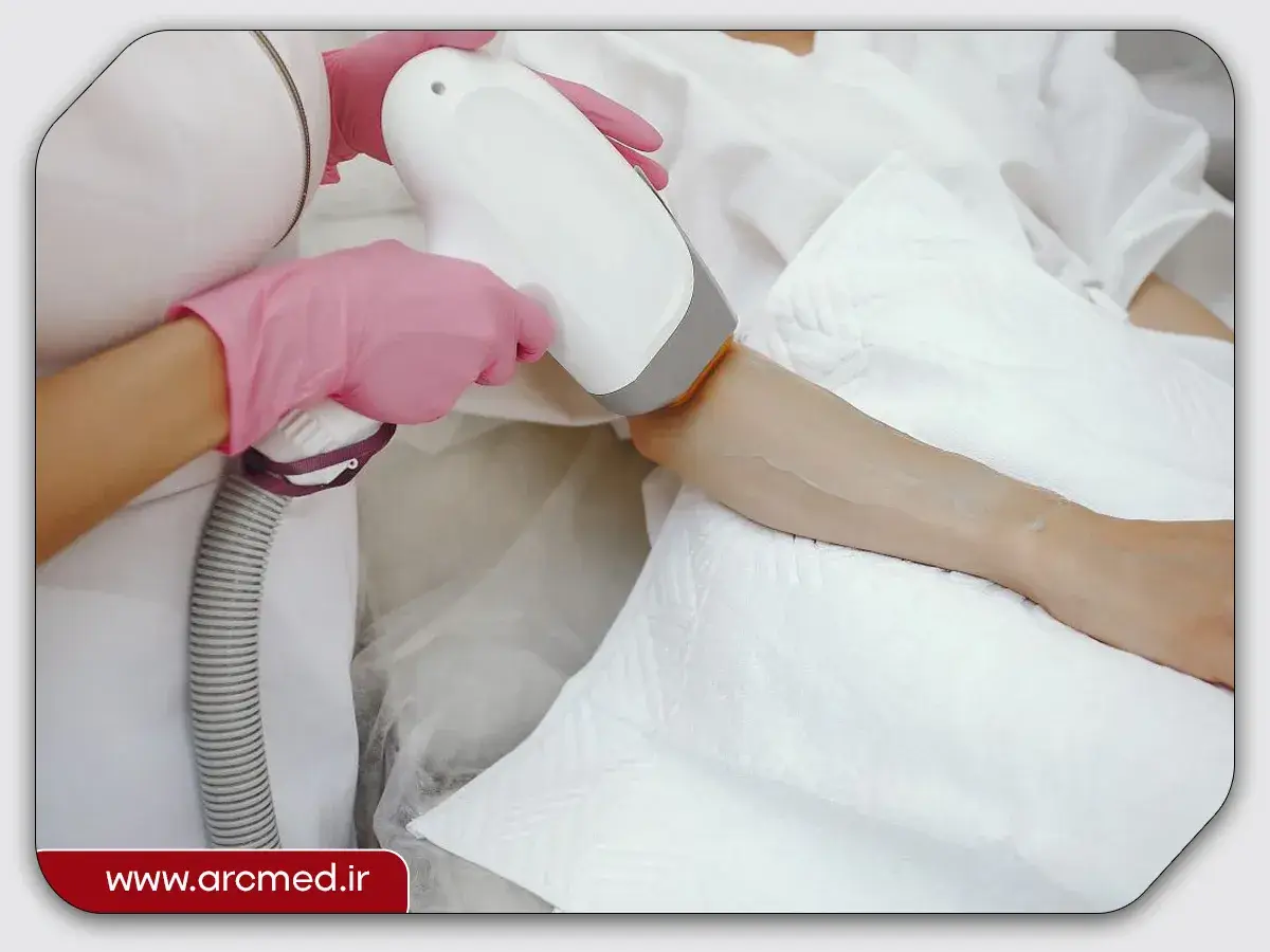 تفاوت دستگاه لیزر دایود و الکساندرایت 1 لیزر دایود و الکساندرایت