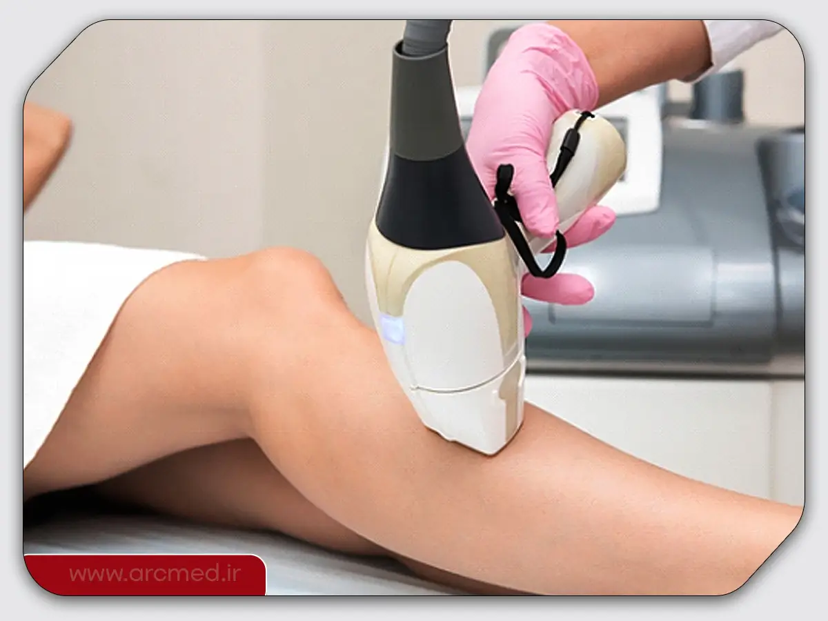 بهترین دستگاه لیزر موهای زائد برای پوست روشن 1 لیزر پوست روشن