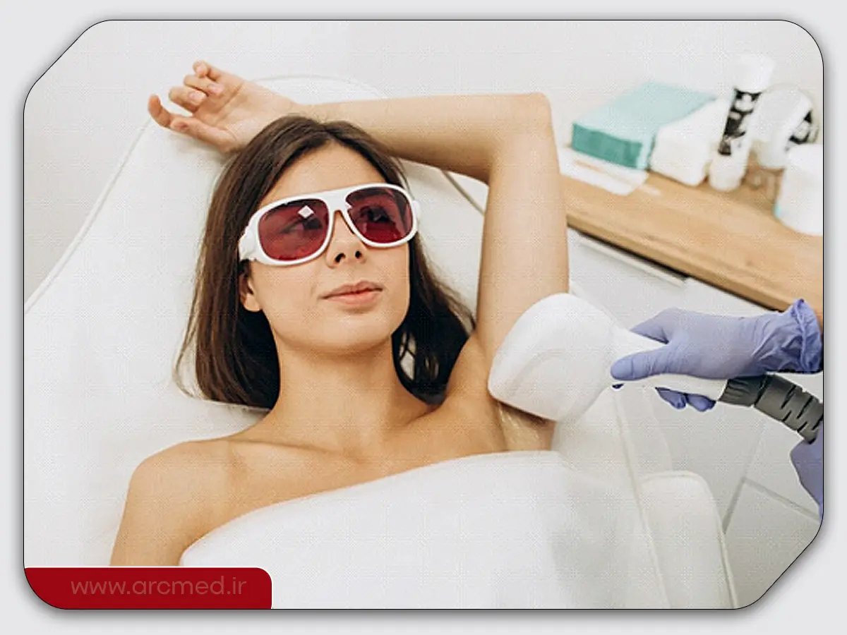 لیزر موهای ضخیم