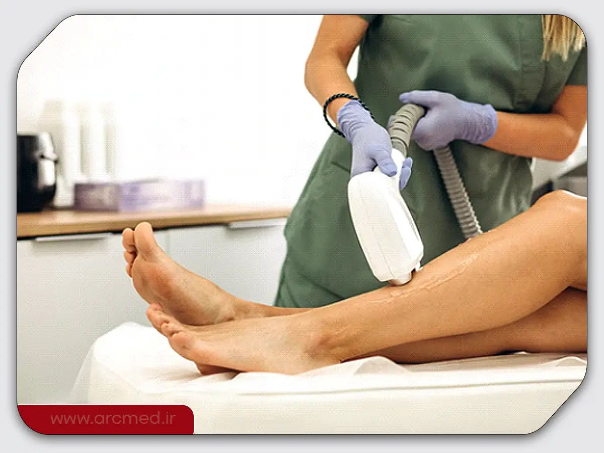 بهترین لیزر برای موهای ضخیم